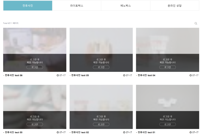 [무료설치] 전후사진 (befor after) 게시판. +@ 모달 팝업 기능