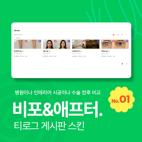 [티로그 게시판01] 비포&애프터 게시판 스킨